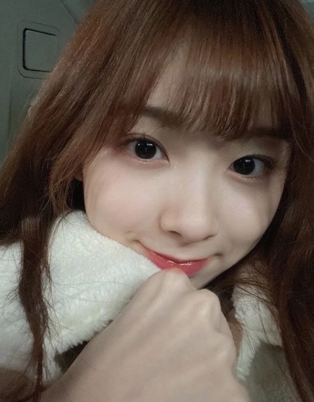 NiziU(ニジュー)のミイヒの歯がない?歯列矯正に失敗した?