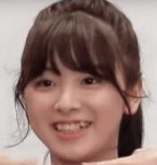 NiziU(ニジュー)のミイヒの歯がない?歯列矯正に失敗した?