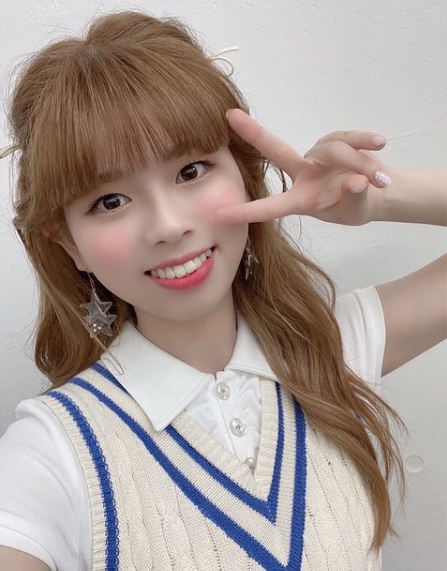 NiziU(ニジュー)リクの歯がない?!何故抜歯したのか、変化はあったのか徹底調査!