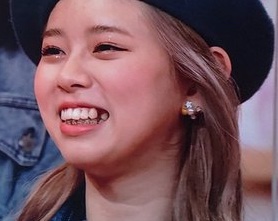 NiziU(ニジュー)リクの歯がない?!何故抜歯したのか、変化はあったのか徹底調査!