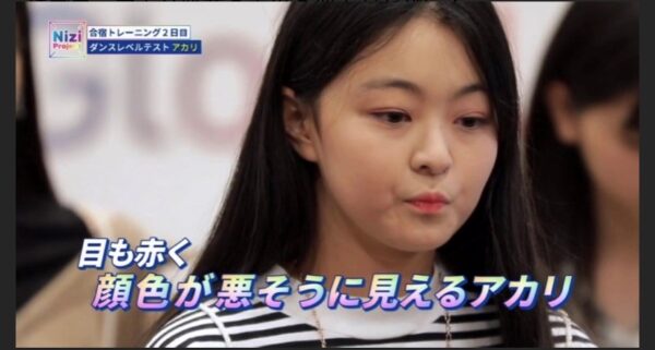 Niziu(ニジュー)に落ちたメンバー「アカリ」の現在|なぜ落ちた?落選理由は?