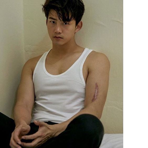 2PMテギョンの腕の傷・ケガの理由は?兵役に影響はあった?