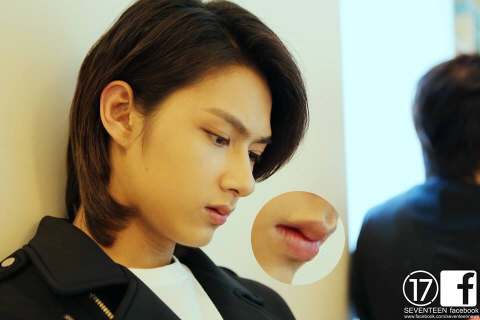 SEVENTEENジュンはほくろ除去や目の整形してる？画像で検証してみた！